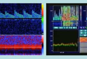 Proposals for Standard Examination of Right-to-Left Shunt